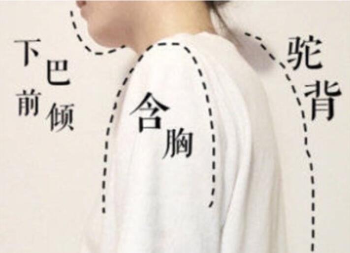 南寧美容學(xué)校：堅(jiān)持一個(gè)月，駝背變直背