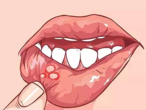身體發(fā)出信號，你該補(bǔ)維生素了