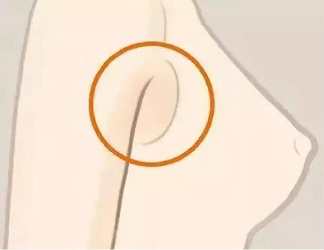 減副乳，瘦手臂一招就解決！