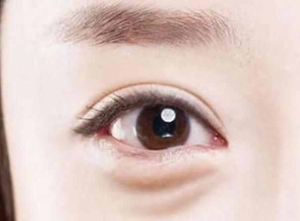 眼袋？淚溝？臥蠶？南寧美容學(xué)校教你辨別