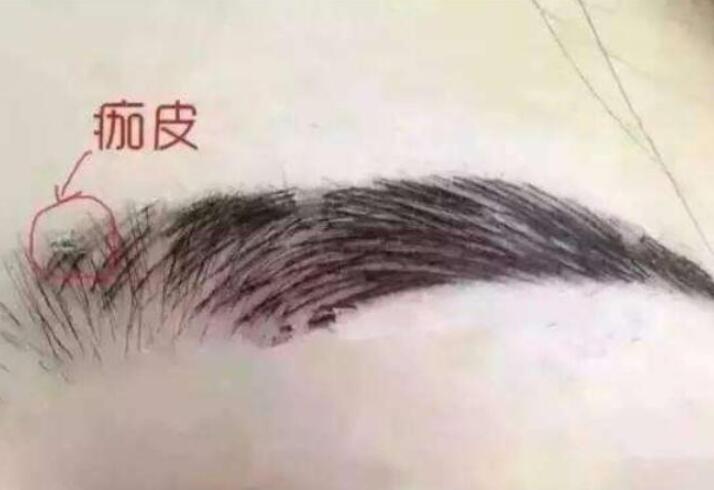 紋眉結(jié)痂時(shí)要注意什么？麗紋竹繡學(xué)校教你