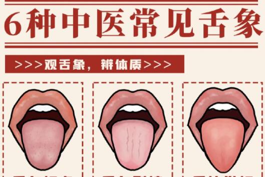 6種常見中醫(yī)舌診判定，快和廣西中醫(yī)美容一起學