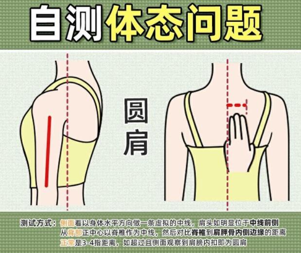 你真的是駝背嗎？廣西美容美體學(xué)校教你自測(cè)