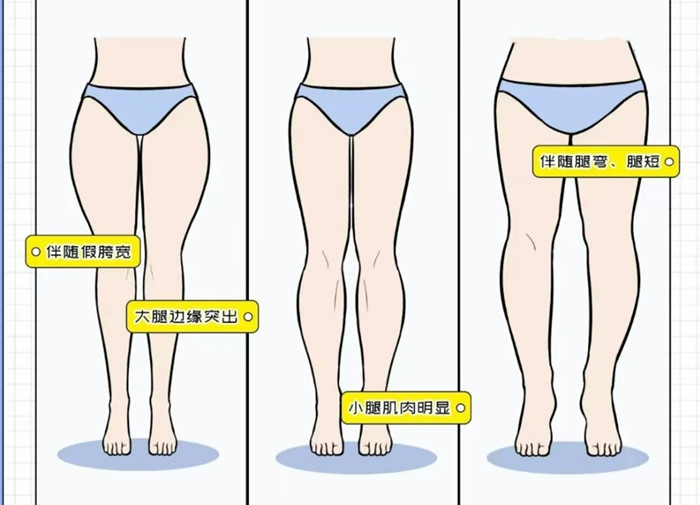 腿粗女生穿搭攻略，廣西彩妝造型搭配