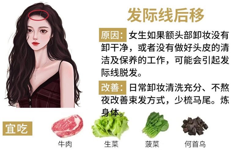 如何改善掉頭發(fā)？南寧頭療養(yǎng)發(fā)護發(fā)教學(xué)