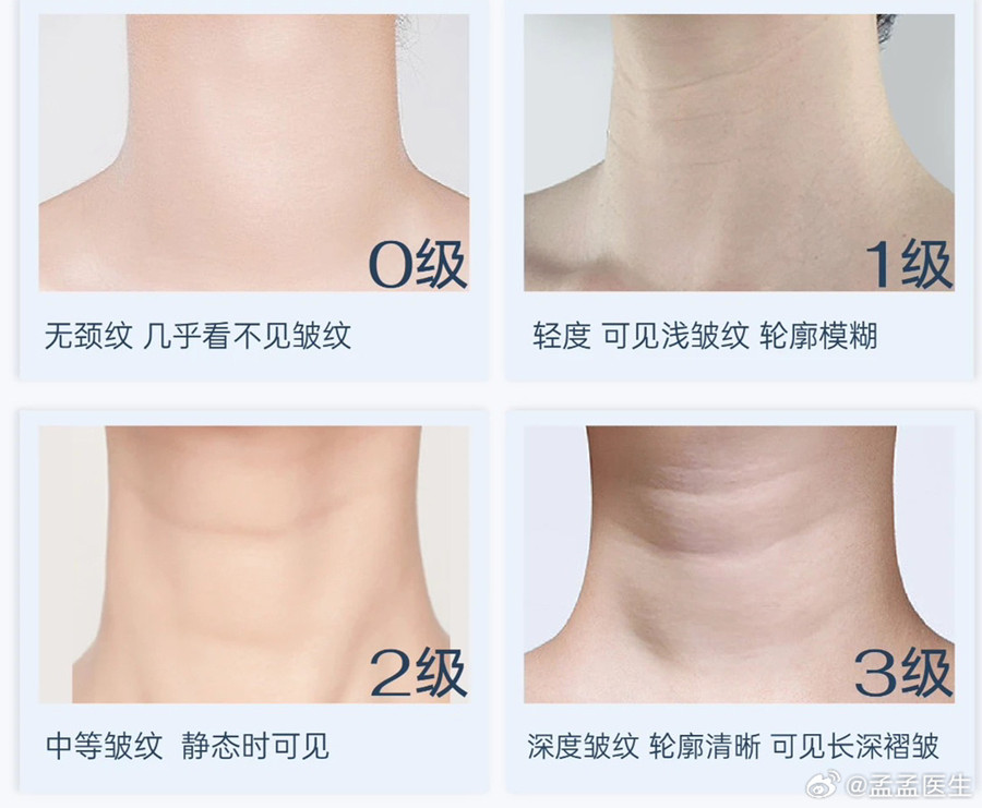 如何緩解頸紋？南寧美體美容管理培訓