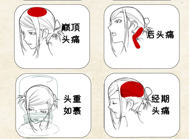 不同頭痛類型經(jīng)絡(luò)護(hù)理方法，廣西中醫(yī)美容培訓(xùn)